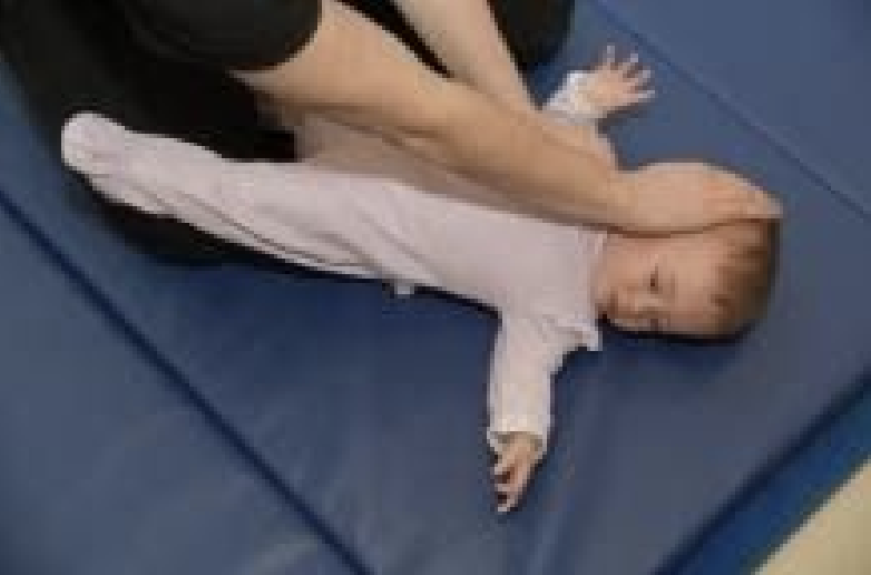 What Is Torticollis North Valley Pediatric Therapy